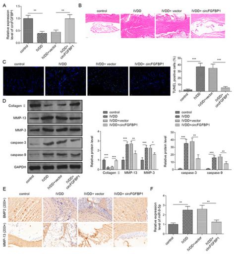 FOXO3-Activated circFGFBP1 Inhibits Extracellular Matrix Degradation ...