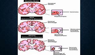 Image result for Neurochemistry