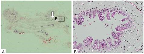 Proposal for Endoscopic Ultrasonography Classification for Small ...