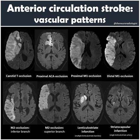The Neuroradiologist (@theneuroradguy) on X in 2025 | Medical radiography, Radiology, Neurology