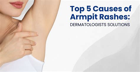Rash Under Armpit Treatment How To Treat Armpit Yeast Infection