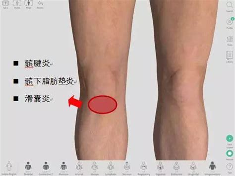 膝盖不同位置疼痛对应的可能病症 或与跑姿跑量相关_跑步频道_新浪竞技风暴_新浪网