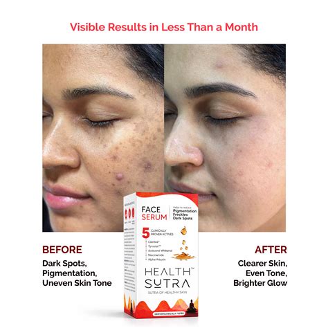 Face Serum with Claritea® for Pigmentation & Dark Spots | 30ml – Health ...