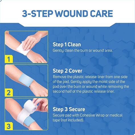 What Kind Of Dressing For Burns at Theresa Moore blog