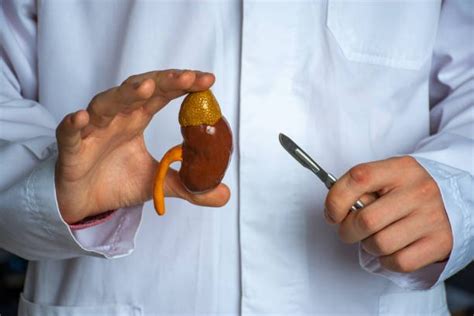 Image result for Simple Nephrectomy