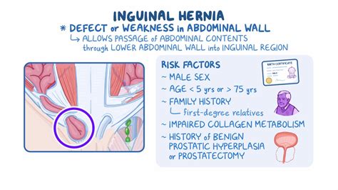 Inguinal hernias: Clinical sciences - Osmosis Video Library