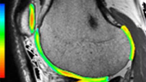 Neurology Advanced Visualization | GE Healthcare (India)