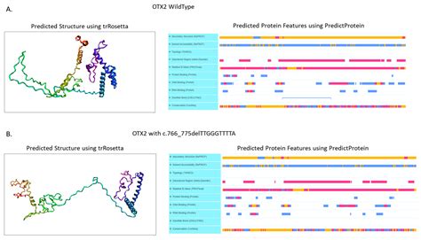 Agnathia-Otocephaly Complex Due to a De Novo Deletion in the OTX2 Gene