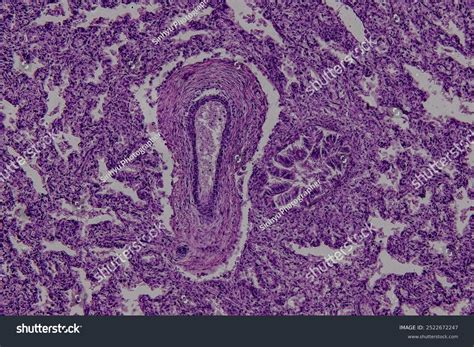 Image result for Tissue Sample Drawing Under Microscope
