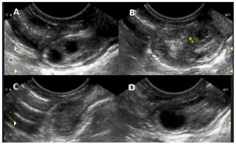 Ovarian Follicular Dynamics and Its Functional Significance in Relation with Follicle Deviation ...