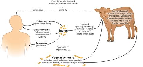 Bacillus anthracis (Anthrax) - Clinical Tree