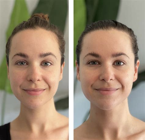 Gua Sha Before And After: Does It Actually Work? – Wips Live