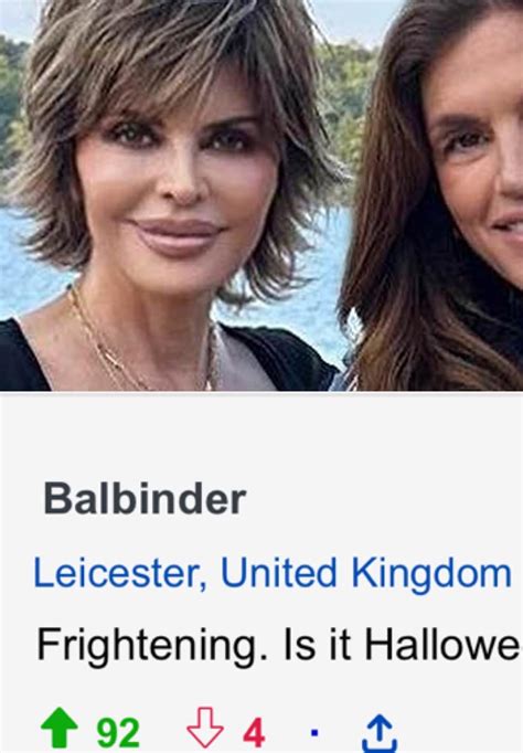 Lisa Rinna Plastic Surgery Disaster