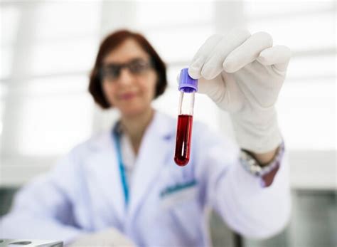 Fasting vs Non-Fasting Lipid Profile Tests: A Complete Comparison ...