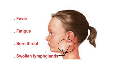 Lump On Jaw After Dental Injection at Jamie Gibb blog