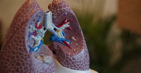 Post Mortem Study On 10 COVID-19 Patients Shows Major Damage To Lungs ...