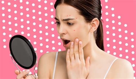What is Hormonal Acne and How to Deal With It