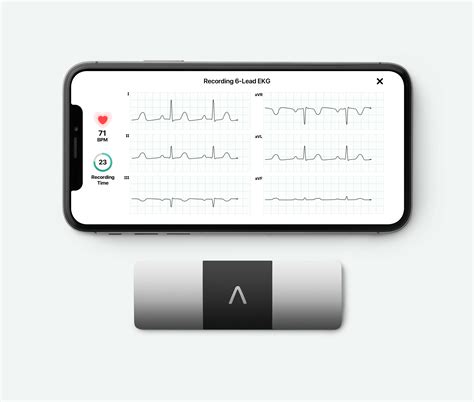 Kardia Mobile 6L – kardia Medical