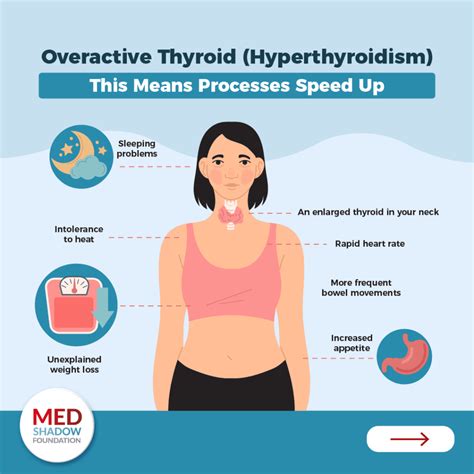 Thyroid Problems: Symptoms, Treatments and Side Effects - MedShadow Foundation | Independent ...