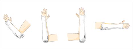 Ulnar Gutter Splint Pattern