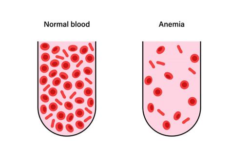 Image result for Normal Values of Blood Components