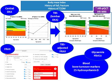Trabecular Bone Score (TBS) in Individuals with Type 2 Diabetes Mellitus: An Updated Review