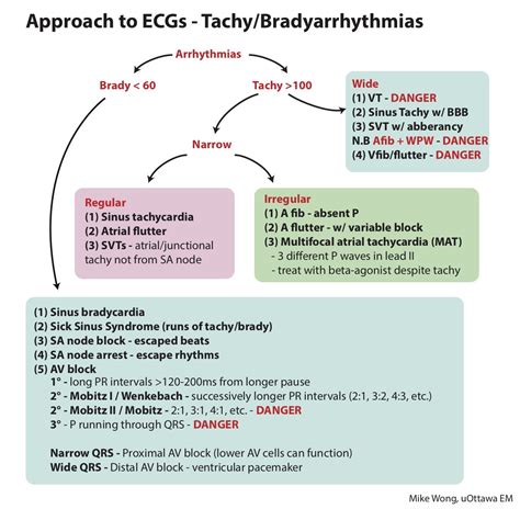 Approach to ECGs - Tachy/Bradyarrhythmias Tachyarrhythmias ... | Pr interval, Medical anatomy ...