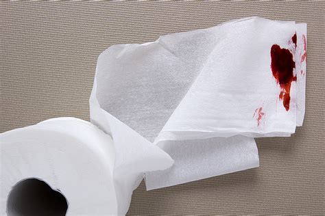 Colon Cancer Blood Clot In Stool Picture - Toilet Paper In The Blood â€“ gutCARE : After which ...