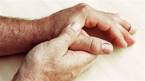 AG Biologika – Update entzündliche Hauterkrankungen – Teil 2 ...