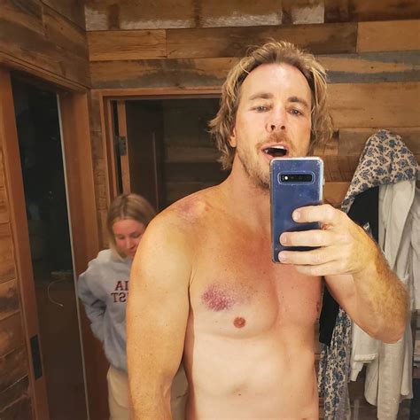 Dax Shepard Needs Surgery After Breaking Multiple Ribs in Motorcycle Accident - E! Online - CA
