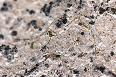 Bacteria Reproducing Under a Microscope 的图像结果