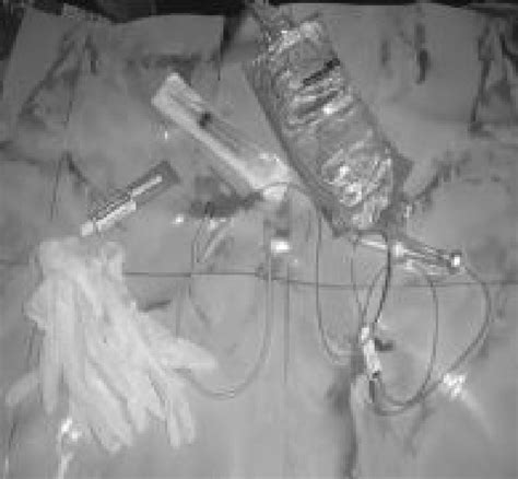 Hydrostatic Reduction of Intussusception 的图像结果