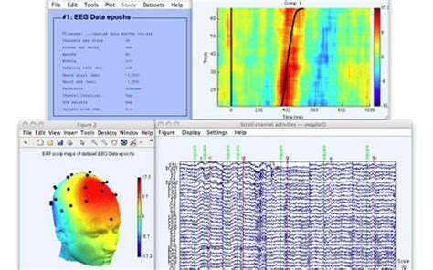 EEG MATLAB Load File 的图像结果