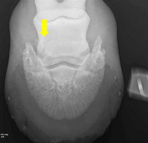 Fractures of the Navicular Bone in Horses - Musculoskeletal System - Merck Veterinary Manual