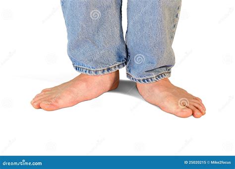 Extemely Flat Feet and Fallen Arches Stock Image - Image of health, orthopedics: 25020215