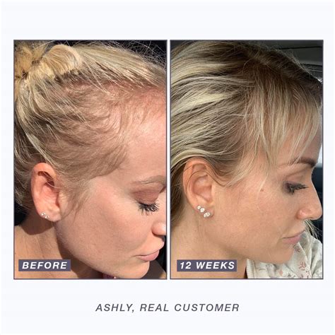 Buy NULASTIN Hair Serum - Follicle Fortifying Conditioner with ...