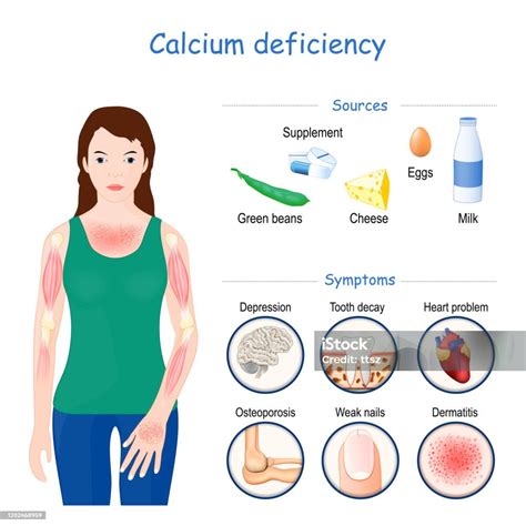 How To Spot Calcium Deficiency at Douglas Wilder blog