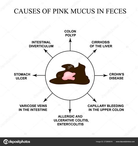 Mucus In Human Feces
