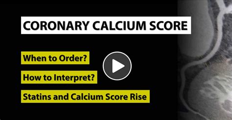 Coronary Calcium Score: Nuts and Bolts