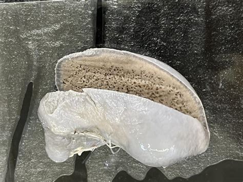 FETAL SPLEEN | NAMO Medical Education & Research Institute