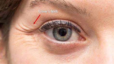 Crows Feet Eyes - Nutt So Ruff