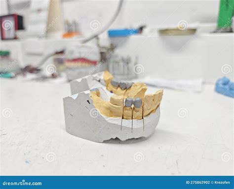 Metal Caps for the Manufacture of Dental Ceramic-metal Dental Bridges Stock Photo - Image of ...