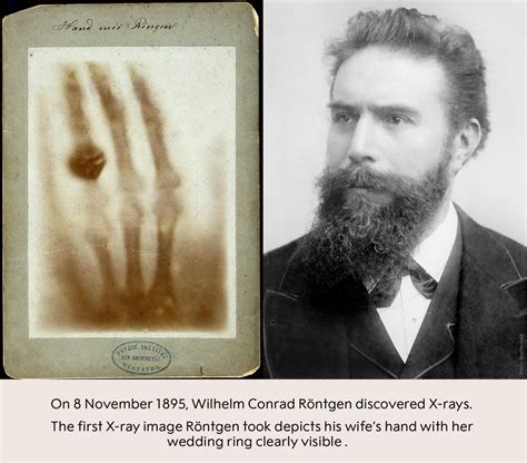 OnThisDay in 1895, Wilhelm Conrad Röntgen discovered X-rays. Röntgen named the discovery X ...