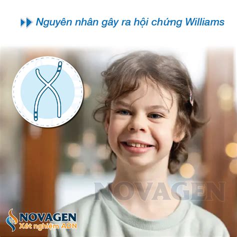 Nhiễm Sắc Thể Số 7 Là Gì? Hiểu Về Vai Trò, Bệnh Lý Và Phương Pháp Điều Trị