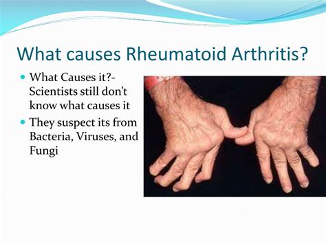 Image result for Skeletal System Muscular System