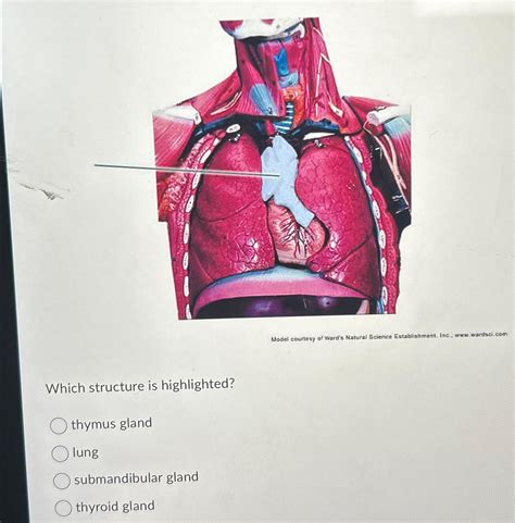 Solved Model courtesy of Ward's Natural Science | Chegg.com