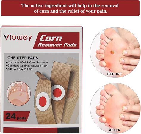 Viowey 24Pads Corn Remover Pads Wart Remover Foot Corn Remover Patch ...