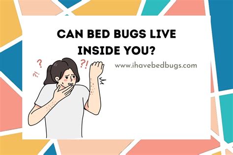 Can Bed Bugs Live Inside You? - ihavebedbugs.com