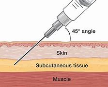 subcutaneous tissue 的图像结果
