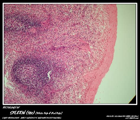 White Pulp Microscope